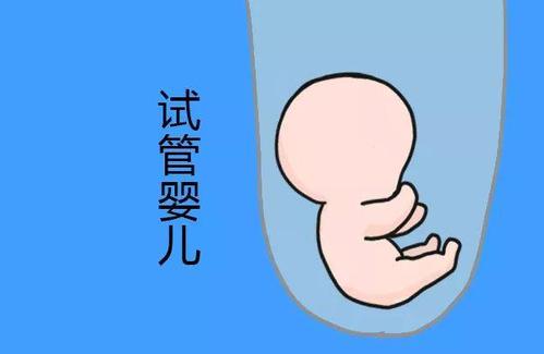 李雪梅
